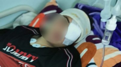 صفاقس : حجارة تُحيل تلميذ على المستشفى