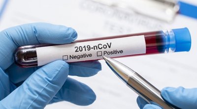 كورونا : تونس تسجل حالتي وفاة و72 إصابة جديدة في تونس