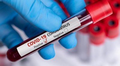 Tunisie-Covid-19: 18 décès, 7144 nouveaux cas et taux de positivité à 33,75%