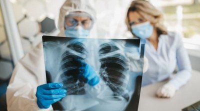 خبيرة : فيروس كورونا فقد قدرته على اختراق أنسجة الرئتين