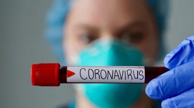 سمر صمود: إمكانية بقاء كورونا في جسم المصاب بالسيدا لأشهر والتسبب في عدوى طويلة الأمد