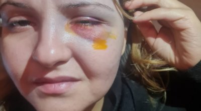 المنزه 6 :تعرضت للعنف من طرف مواطن ..فتحولت إلى متهمة (صور)