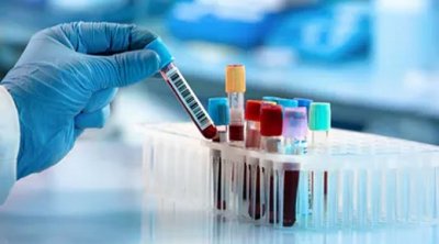 Tunisie-Coronavirus : 12 décès,666 nouveaux cas