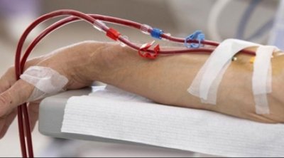 12 ألف شخصا في تونس يخضعون الى عملية تصفية الدم