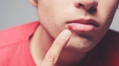 41 طفلا يتعالجون من فيروس السيدا في تونس خلال سنة 2021