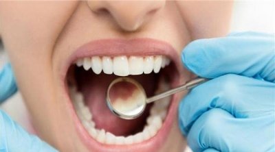 قريبا : زيادة منتظرة في طب الأسنان
