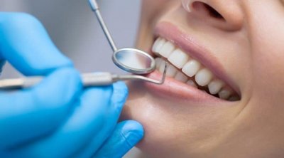 النقابة التونسية لأطباء الأسنان : لا توجد زيادات في التعريفة