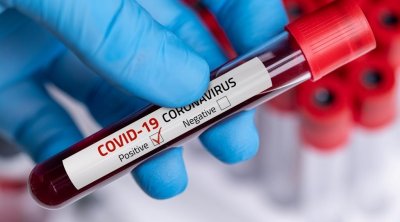 Tunisie-Covid19 : 182 contaminations supplémentaires 