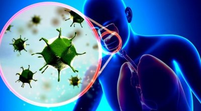 أخطر من كورونا..تحذير من سلالة فيروسية ''قاتلة'' تنتشر حاليا في العالم