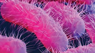 تسجيل قرابة 120 إصابة بـالشيغيلا في تونس