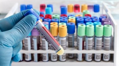 Tunise-Covid-19: 73 nouvelles contaminations et 01 décès