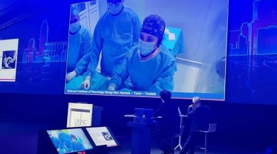 كفاءات طبية تونسية تجري عمليتان لمعالجة تشوه أوعية دموية خلال بث مباشر في باريس 