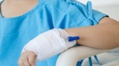 نابل : قاصران يضرمان النار في جسد طفل الـ8 سنوات 