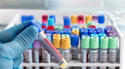 تونس تسجّل أوّل إصابة بالمتحور الجديد لكورونا لدى رضيع