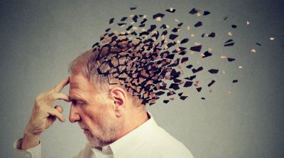 بإستخدام الذكاء الاصطناعي..العلماء يكتشفون سببا جديدا لتطور الزهايمر