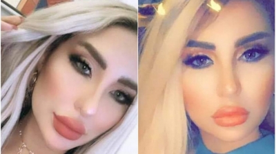 العاصمة : وفاة مواطنة تونسية بسبب عملية تجميل 