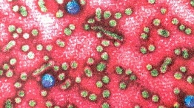 تسجيل 10 إصابات ''بالبوصفير'' في مدرسة ابتدائية بالسبيبة