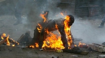 وفاة شقيق احد باعة باب الجزيرة متأثرا بحروقه 