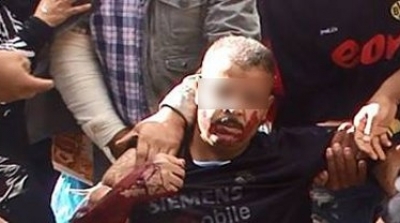 بعد منعه من مقابلة والي قفصة : مواطن يعتدي على جسده بشفرة حلاقة