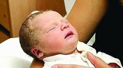 امرأة مجرية تضع مولودا بعد وفاتها اكلينيكيا 