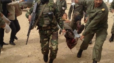 القصرين: اصابة عسكري بطلق ناري على وجه الخطأ