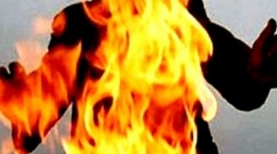 شاب يضرم النار في جسد والده بالقصرين