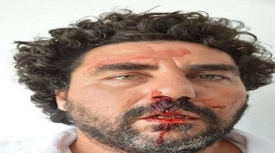 الاعتداء على المدير الفني لمهرجان قربة لمسرح الهواة   