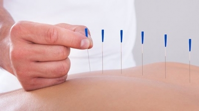 مركز للاستشفاء الصيني بجندوبة لعلاج الالم بواسطة اليات الطب البديل