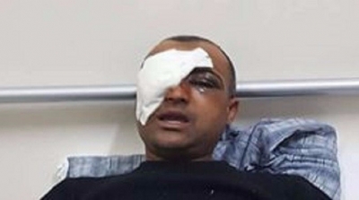 عون شرطة بلديّة يتعرّض للسطو بالاسلحة البيضاء و الهراوات