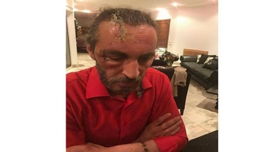الاعتداء على مخرج الهاكم التكاثر : اصوات الظلام تعود من جديد