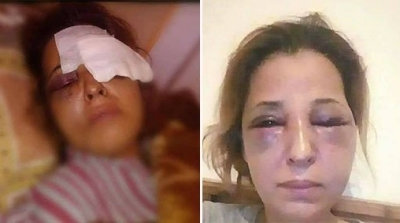 سوسة : استاذة تتعرض للاعتداء بالعنف من قبل زوجها و اعوان الامن يرفضون تسجيل شكاية ضده 