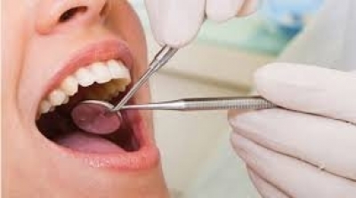 Pas d'augmentation dans les honoraires des médecins dentistes