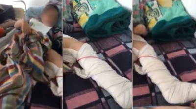 نابل : معلم يعتدى بالعنف الشديد على تلميذ و يتسبب له في كسر على مستوى الساق