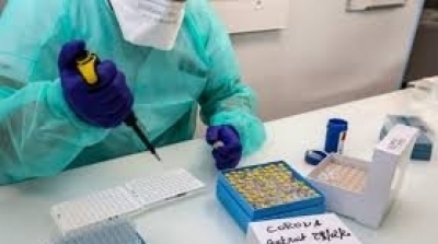 Deux élus du Congrès américain testés positif au coronavirus