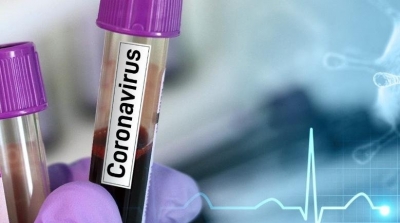 Coronavirus : 22 nouveaux cas en Tunisie