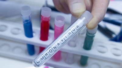 Covid 19-Tunisie : 83 patients hospitalisés à la date du 8 avril