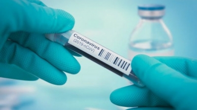 إصابتان جديدتان وافدتان بكورونا في تونس