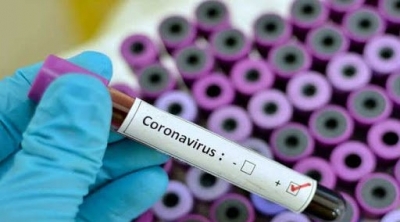 Coronavirus : 198 cas importés testés positifs depuis l’ouverture des frontières
