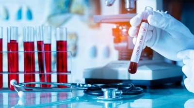 Plus d’entrée en Tunisie sans présentation d’un test RT-PCR négatif