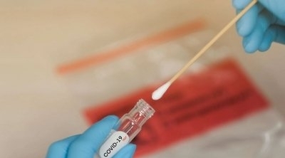 مدير معهد باستور: لقاح كورونا مازال في المرحلة ما قبل السريرية
