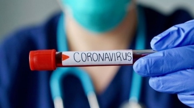 Tunisie : 75 nouvelles contaminations par le coronavirus
