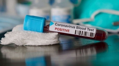 COVID-19 :La Tunisie enregistre 198 nouvelles contaminations