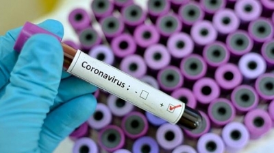 COVID-19 : 470 nouveaux cas de contamination et 4 décès