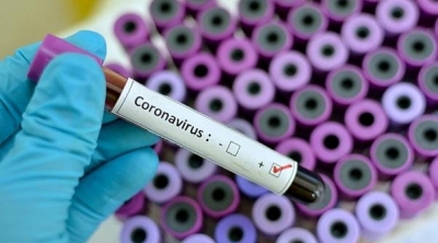 Coronavirus : La Tunisie enregistre 10.732 cas et 159 décès