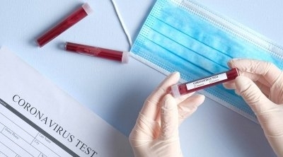 تونس تسجل1291 اصابة جديدة بكورونا