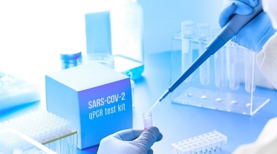 Covid-19 : Des tests RT-PCR à plus de 400 dinars