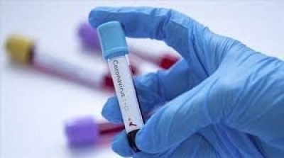Covid-19 : Un vaccin développé par Pfizer et BioNTech 'efficace à 90%"