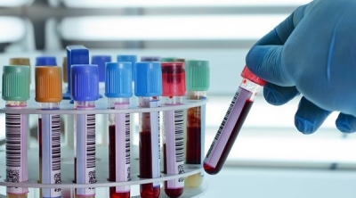Tunisie-Covid-19 : 1424 contaminations en 24h