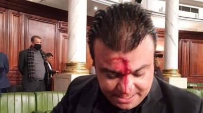 Samia Abou et Anouar Bechahed agressés par des députés d’Al Karama