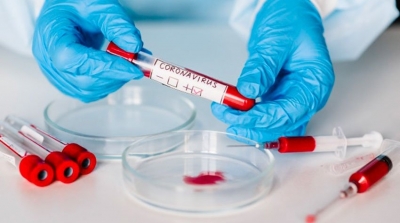 Tunisie-Covid-19 :Le bilan des morts franchit la barre des 7000